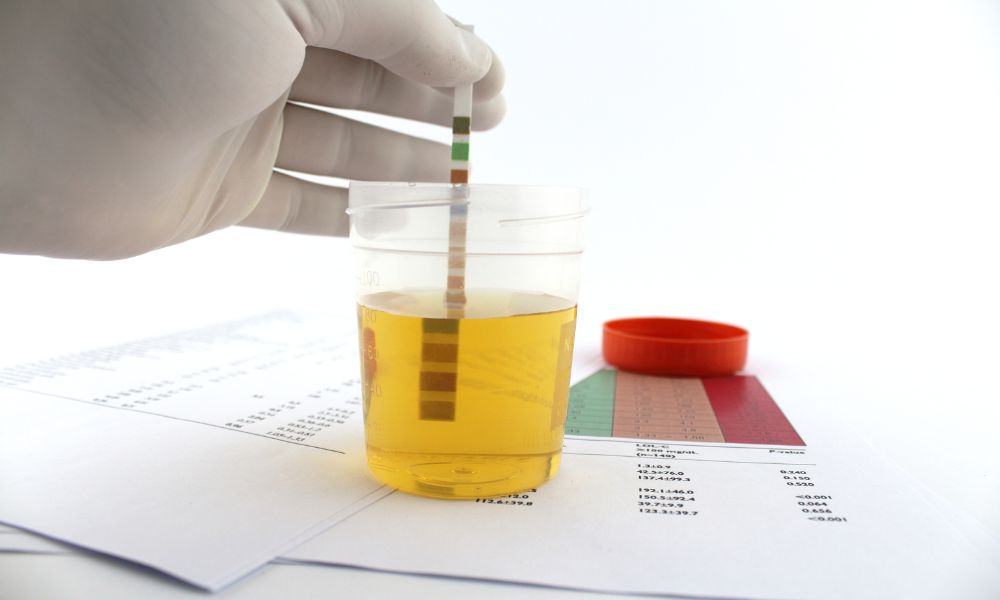 How Long Does CBD Stay In The Urine
